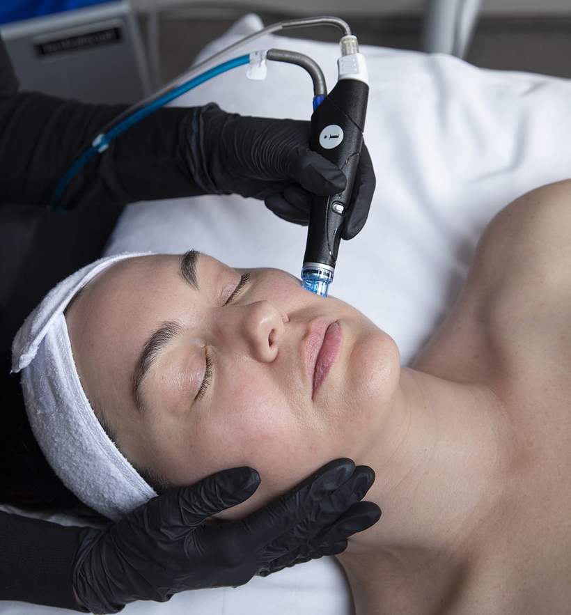 HydraFacial treatment being performed