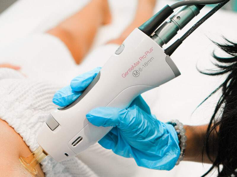 GentleMax Pro Plus laser device