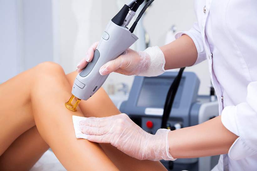 Laser hair removal treatment on legs