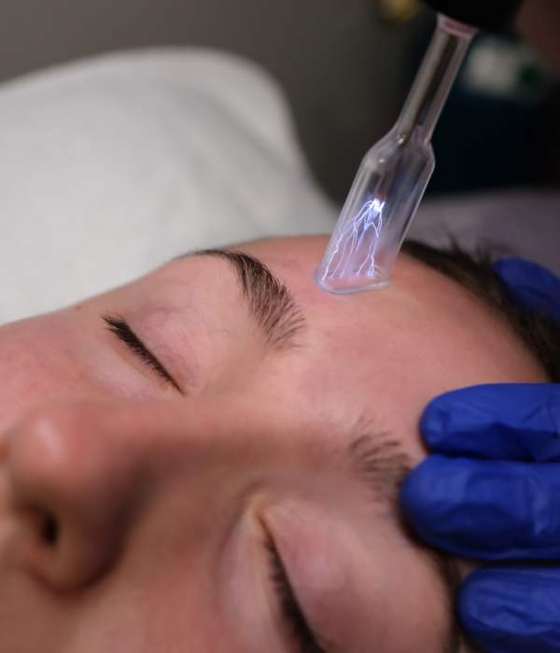Cold plasma therapy