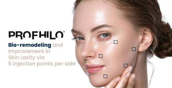 Skin Boosters - Profhilo
